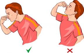 Hur man kan stoppa näsblod