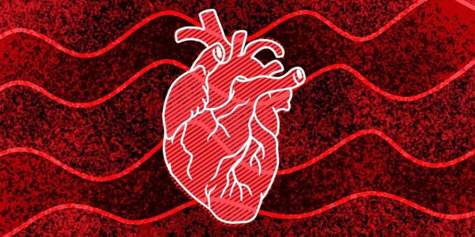 11 tecken på att du kan hända hjärtstillestånd