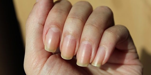 Gula naglar på grund av rött eller orange nagellack
