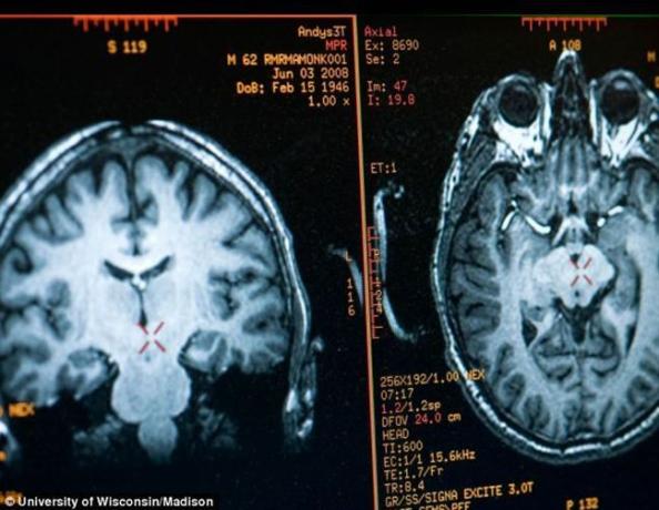 hjärnan Mathieu Ricard bild erhållen med MRI