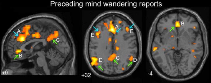 Gröna pilarna indikerar områden av hjärnan som ansvarar för "automatisk beteende". Blå pil - "verkställande" delen av hjärnan. A - dorsal cingulate, B - ventralanya cingulate, C - precuneus hjärnhalvorna, D - bilateral temporoparietal junction, E - dorsolaterala prefrontala cortex