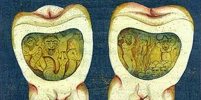 Medeltida medicin: En sida från ottomansk tandvård, 1600 -talet.